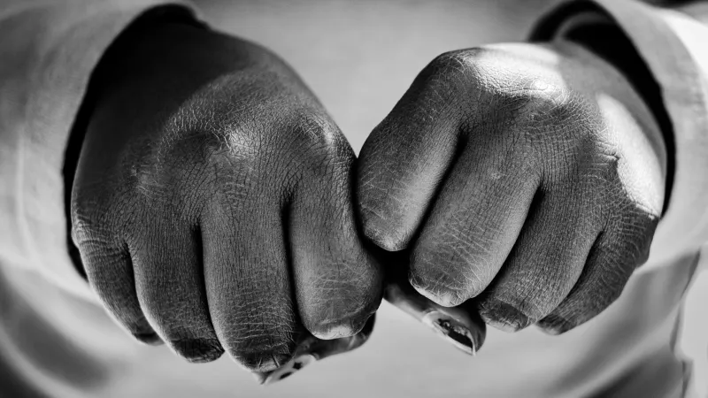 One Man Tested One Hand for 60 Years to Prove Knuckle Cracking Is Harmless — And He Was Right